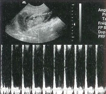 Ultraschalluntersuchung zum Geburtstermin